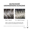 Vichy Dercos DS 2w1 Przeciwłupieżowy szampon z odżywką, 200ml