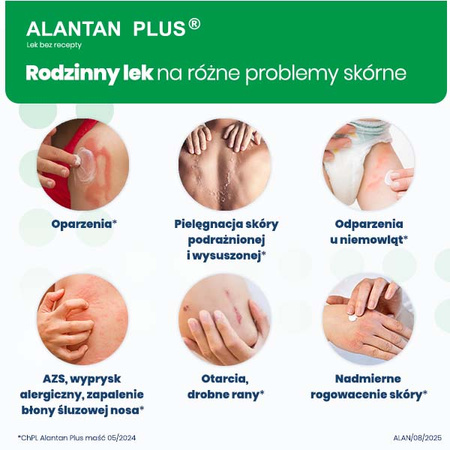 ALANTAN PLUS® maść (20 mg+50 mg)/g Multifunkcyjny lek na problemy skórne, 30g