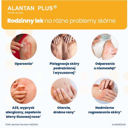 ALANTAN PLUS® krem (20 mg+50 mg)/g Multifunkcyjny lek na problemy skórne, 100g