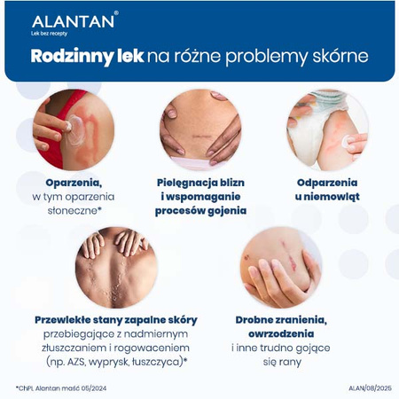 ALANTAN® maść 20 mg/g Multifunkcyjny lek na problemy skórne, 100g