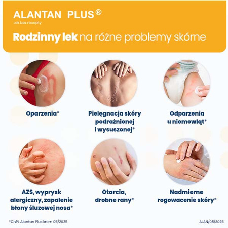 ALANTAN PLUS (20 mg + 50 mg)/g krem 35 g